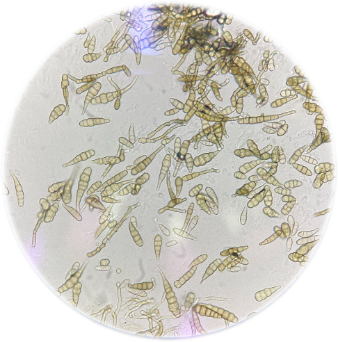 Alternaria spores, also known as conidia, under a microscope.