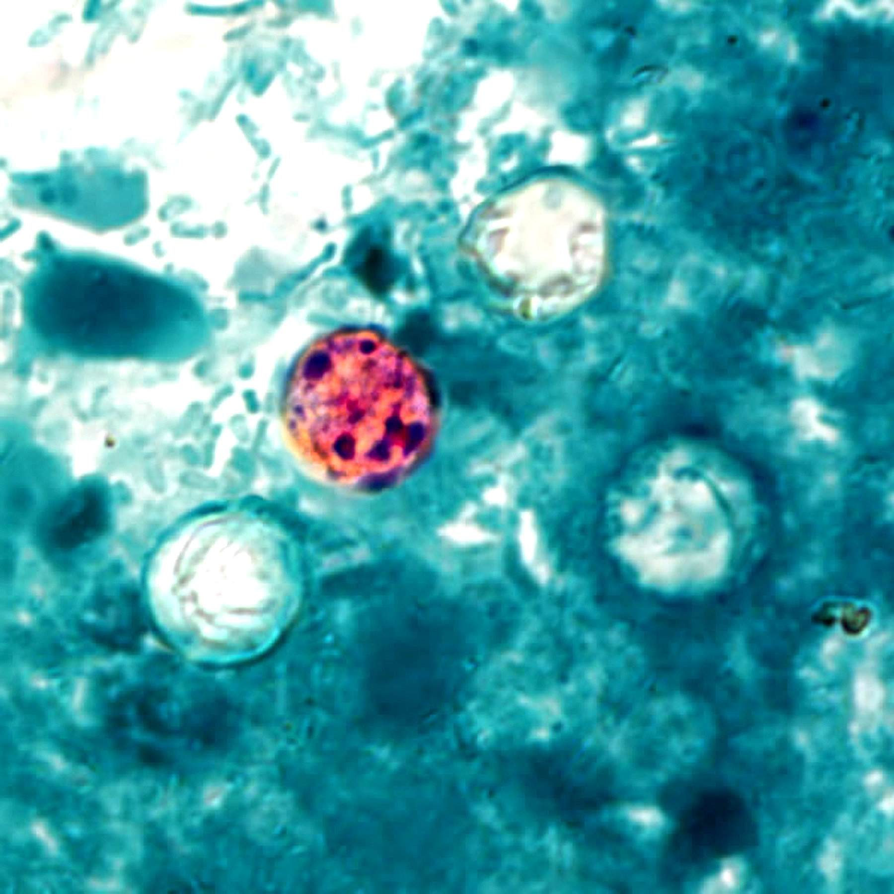 Presence of four cyclospora cayetanensis oocysts.